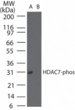 HDAC7, p Ser155 Antibody, Novus Biologicals:Antibodies:Primary Antibodies